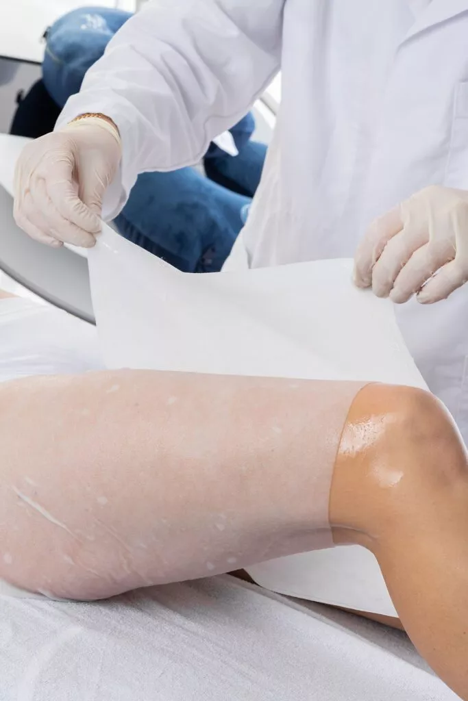 Programme de soins cryolipolyse personnalisé à Marseille à la clinique de médecine esthétique Beige Clinique : votre programme de soins cryolipolyse sur mesure