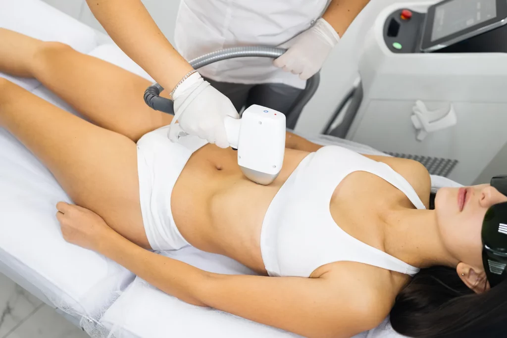 Épilation définitive au laser à Marseille : L’excellence signée Beige Clinique