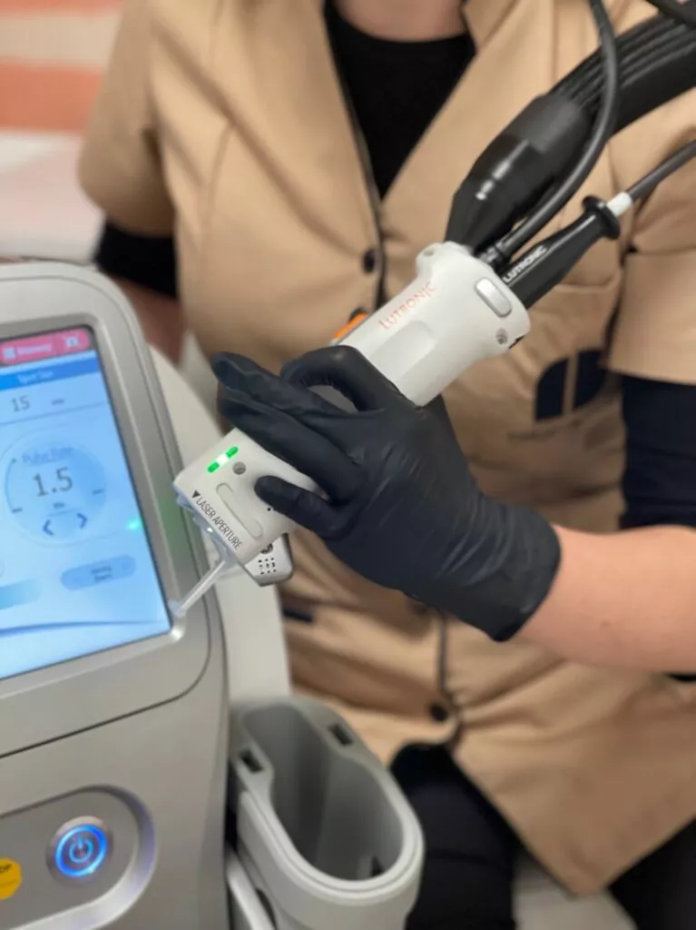 Épilation Laser : Le Guide Complet pour une Peau Douce et Définitive
