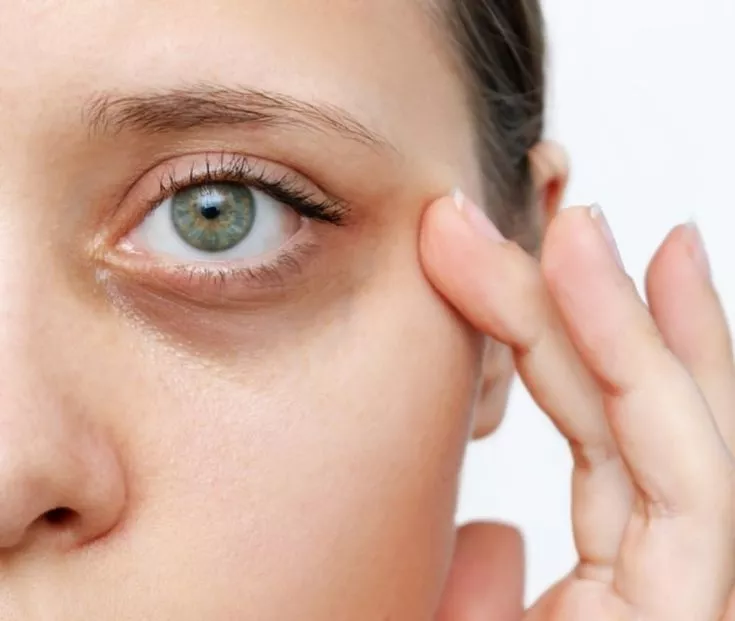 Cernes, poches, teint terne : nos solutions expertes pour un visage reposé