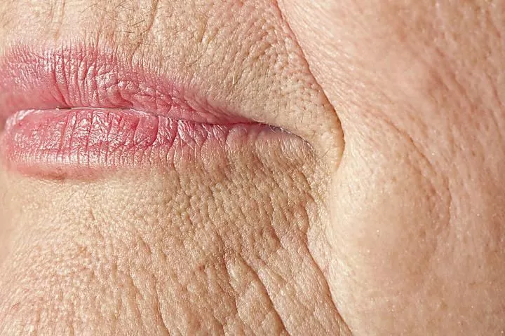 Prévention Anti-Âge dès 30 Ans : L’Atout Jeunesse à Long Terme chez Beige Clinique