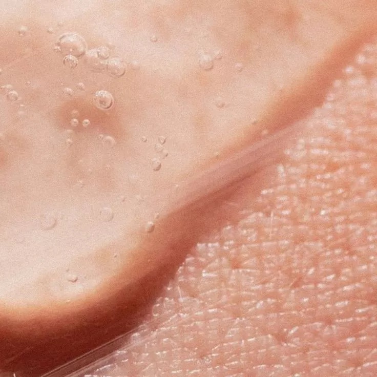 Peau Sensible : Soins Esthétiques Sûrs et Efficaces chez Beige Clinique