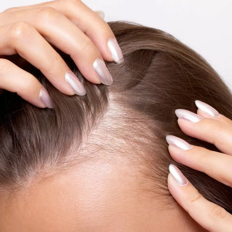 PRP et Mésothérapie Capillaire : La Solution Avancée pour Stimuler la Repousse des Cheveux