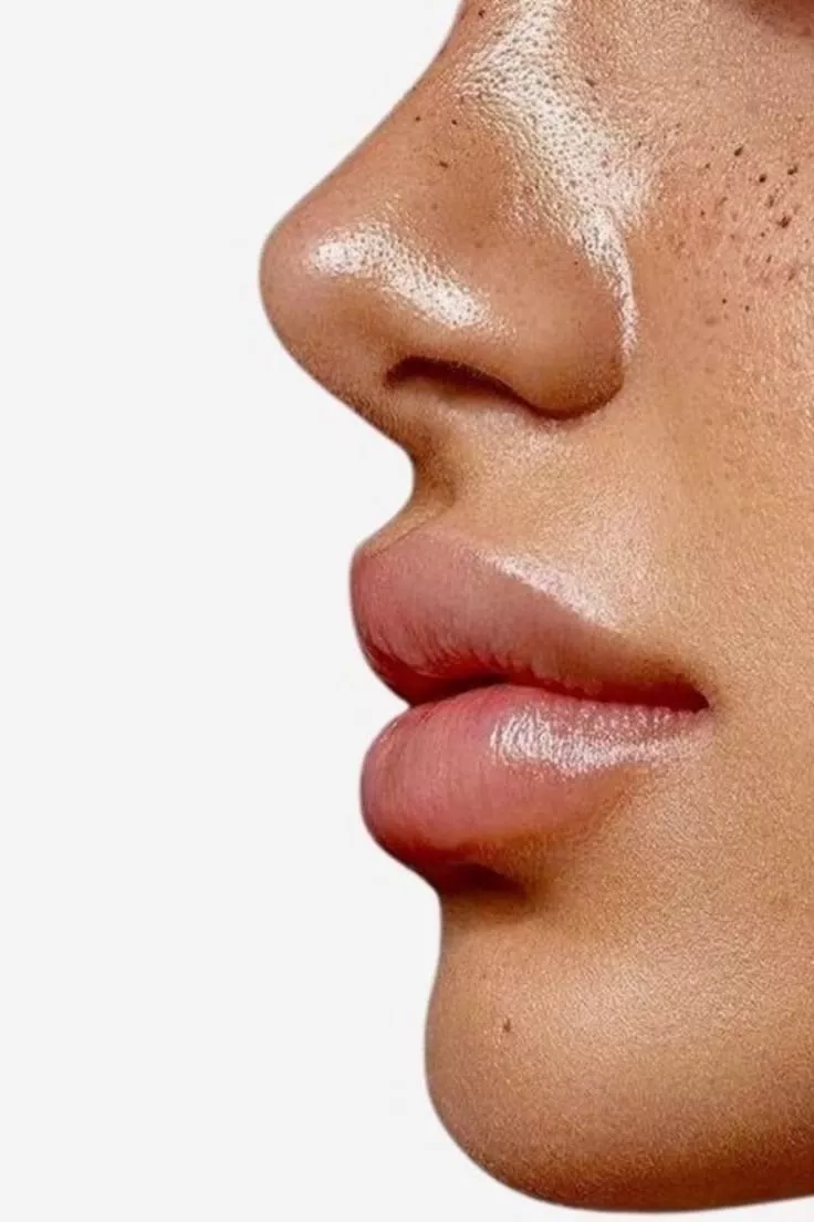 Injections d’acide hyaluronique en été : découvrez les précautions, les avantages et les conseils des experts de Beige Clinique à Marseille pour un résultat naturel et sécurisé.