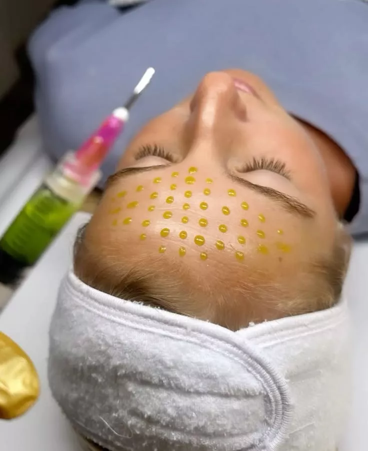Découvrez les skinboosters chez Beige Clinique à Marseille : un soin de médecine esthétique pour hydrater intensément la peau, améliorer son éclat et préserver sa jeunesse.