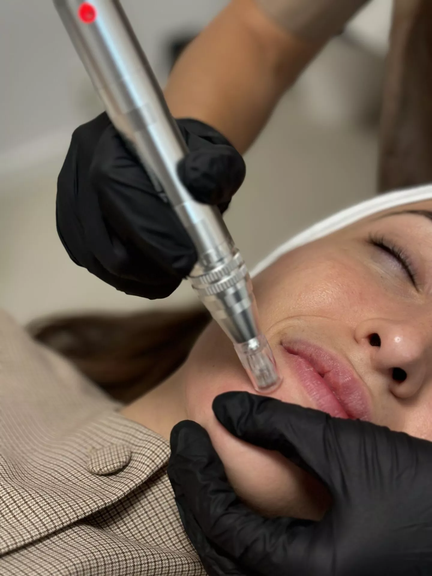 Découvrez le Microneedling chez Beige Clinique à Marseille : un soin ciblé pour améliorer la texture de la peau, atténuer les imperfections et retrouver un teint plus lumineux.