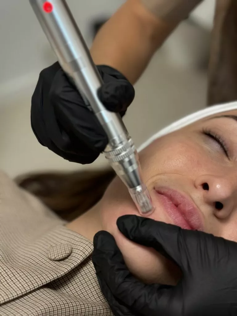 Découvrez le Microneedling chez Beige Clinique à Marseille : un soin ciblé pour améliorer la texture de la peau, atténuer les imperfections et retrouver un teint plus lumineux.